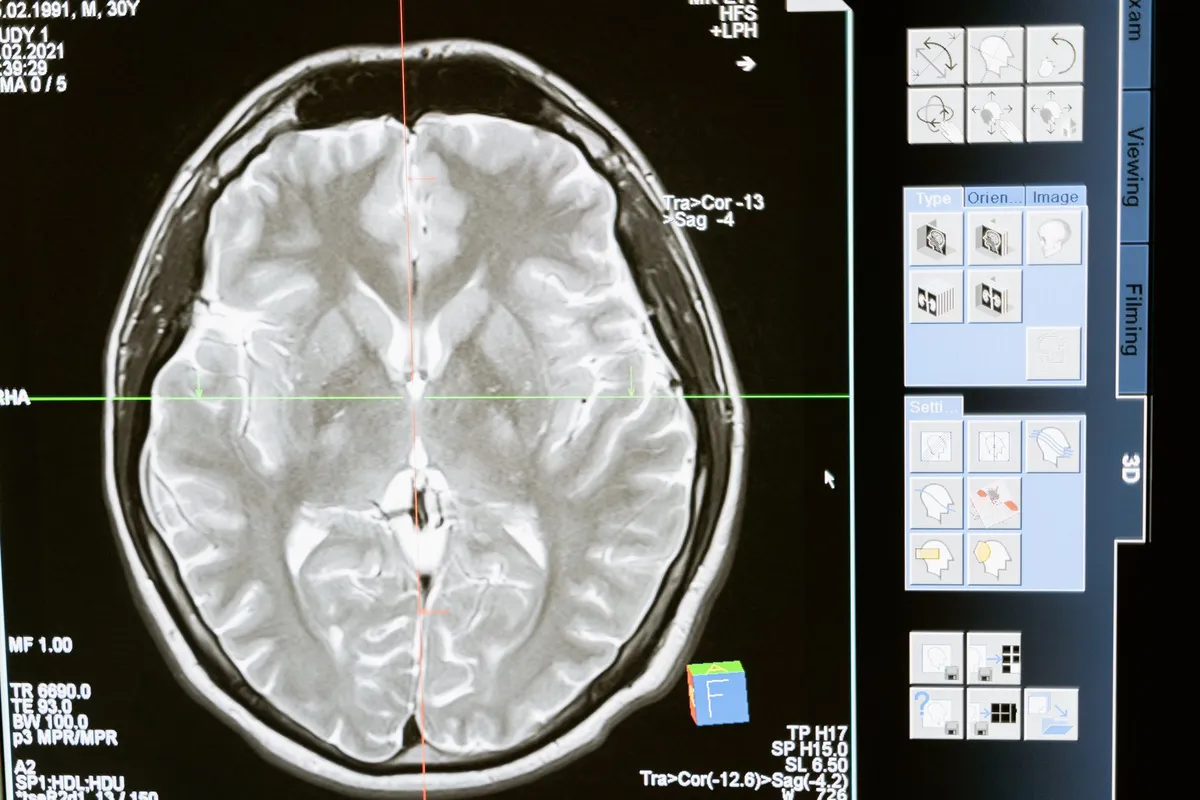 Emulating the Human Brain: Unveiling the Mysteries of Neuromorphic Hardware - Part 01: Spiking Neural Networks Architecture