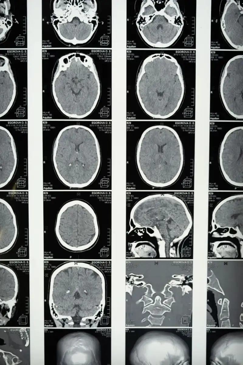 Mind Meld: Unlocking the Potential of Brain-Computer Interfaces
